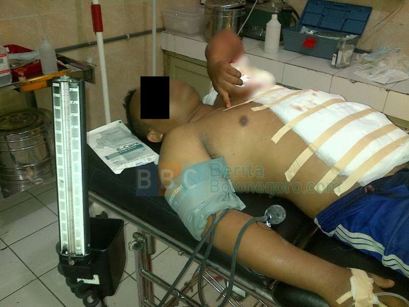 Pengantin Baru Ditusuk dengan Pisau Saat Menyanyi di Panggung 