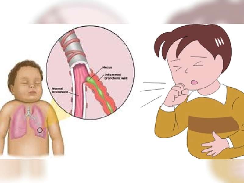 Selalu Tutupi Mulut Ketika Bersin dan Buang Dahak