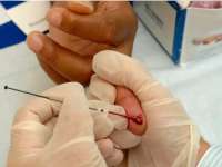 Jumlah Penderita HIV/AIDS di Bojonegoro Peringkat 8 Se-Jatim