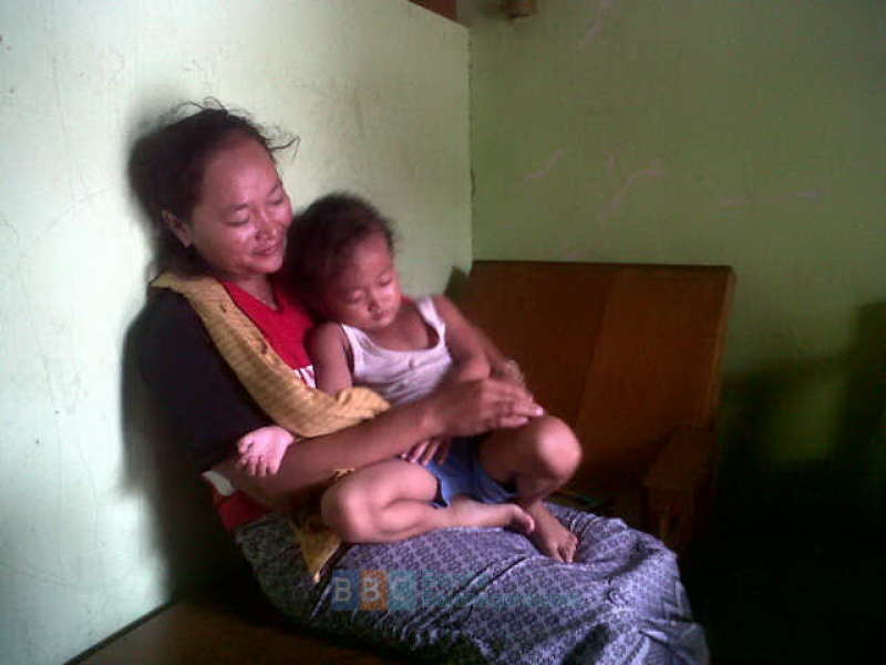 Bocah 4 Tahun Lemas Usai Hirup Gas H2S