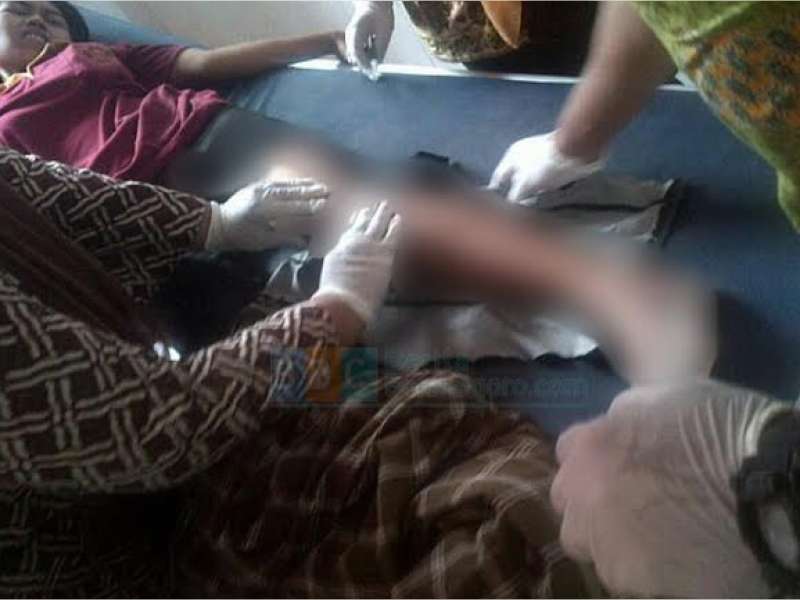 Lampu Sein Mati, Pengendara Motor Jadul Disruduk ‘Bebek’