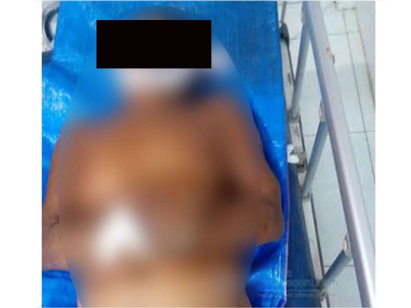 Menyeberang Jalan, Seorang Kakek di Padangan Tewas Ditabrak Motor