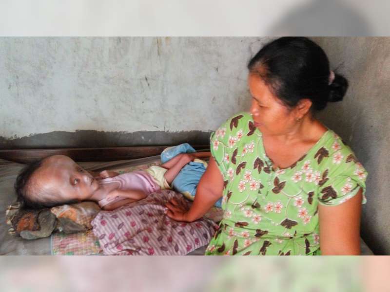 Berjualan Sayur Keliling Kampung demi Merawat Anak yang Menderita Hydrocepalus