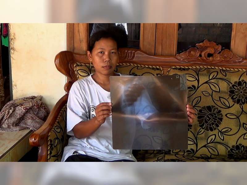 60 Warga Desa Karanglo Mengeluhkan Sakit Ispa Setiap Bulan