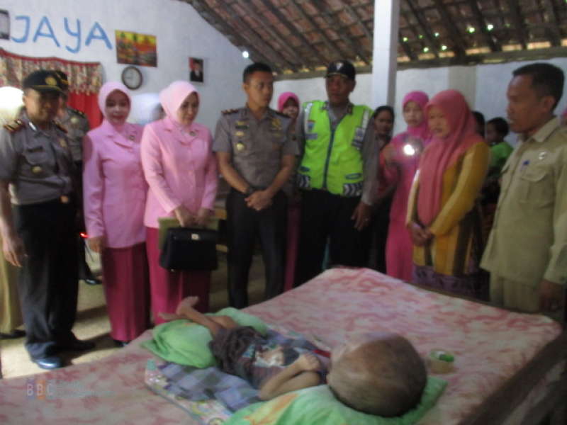 Yayasan Kemala Bhayangkari Kunjungi Penderita Hydrocepalus di Trucuk