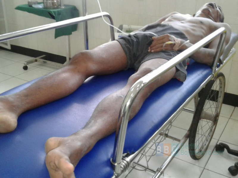 Mr X Korban Tabrak Lari Kritis di RSUD Tuban