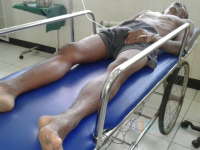 Mr X Korban Tabrak Lari Kritis di RSUD Tuban