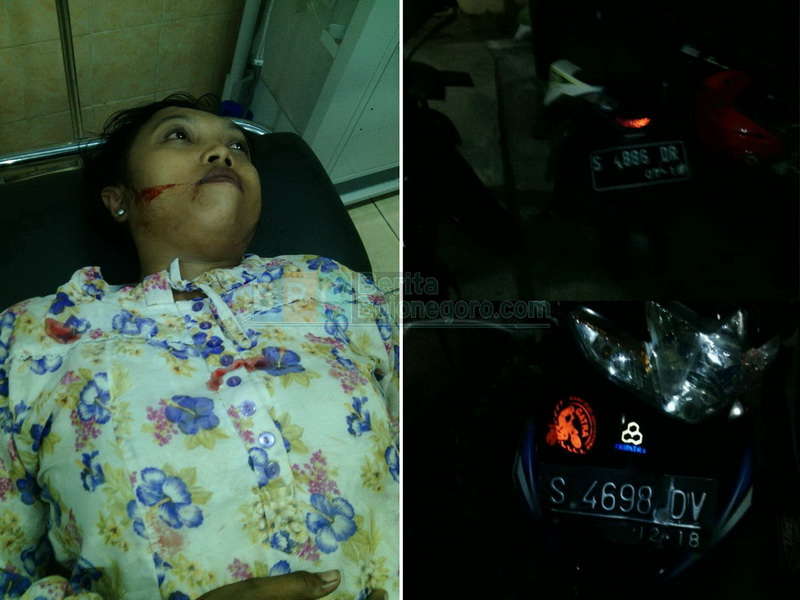 Dua Motor Tabrakan di Perempatan Balen, Satu Terluka