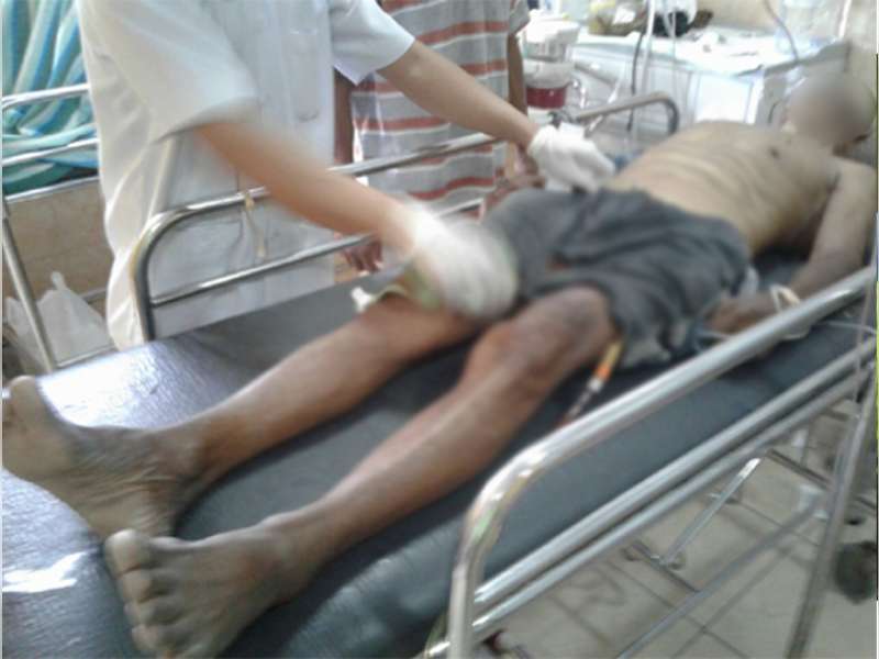 Terserempet Motor, Kakek Pengayuh Sepeda Pancal Jatuh Tak Sadarkan Diri