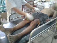 Terserempet Motor, Kakek Pengayuh Sepeda Pancal Jatuh Tak Sadarkan Diri