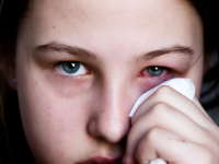 Awas Radang Mata Musiman