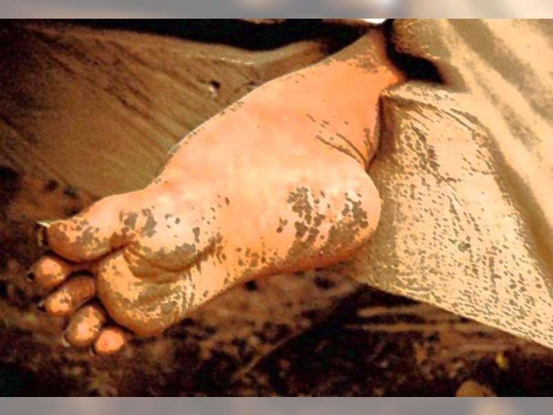 Tahun 2017 Bojonegoro Bebas Pasung