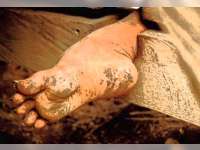 Tahun 2017 Bojonegoro Bebas Pasung