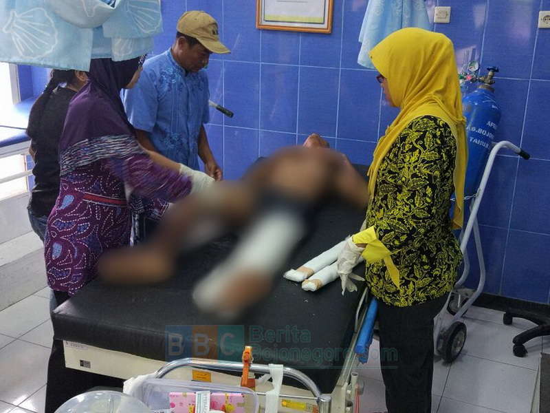 Balik Arah Sembarangan, Pengendara Motor Asal Baureno Celaka