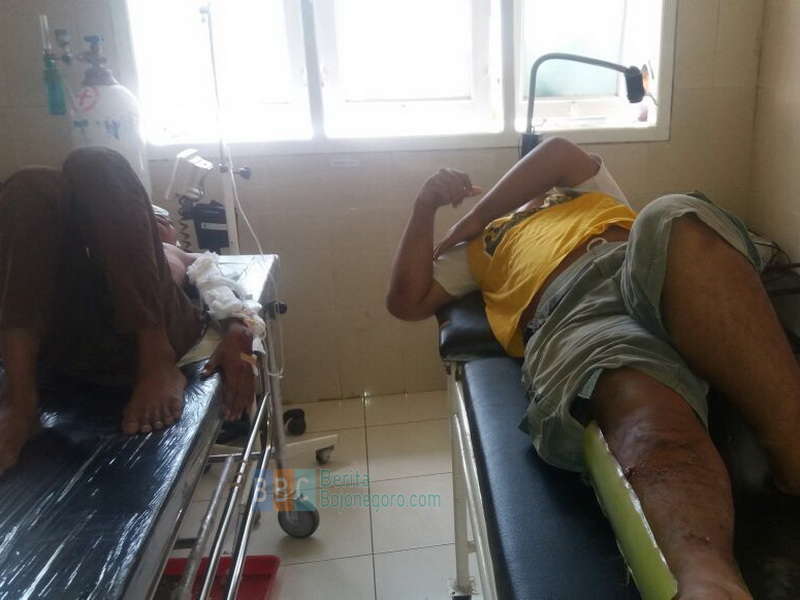 Gara-Gara Putar Balik, Seorang Mahasiswa asal Balen Patah Kaki Kanan