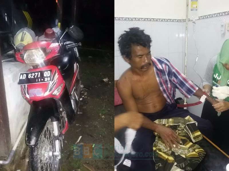 Akibat Jalan Berlubang di Margomulyo, Pengendara Motor Celaka
