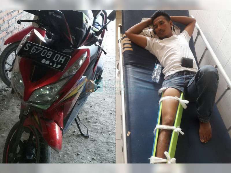 Kurang Konsentrasi, Vario Sruduk Truk di Margomulyo, Pengendara Patah Kaki