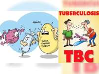 Meningkatnya Kasus HIV Berdampak pada Tingginya Kasus TB
