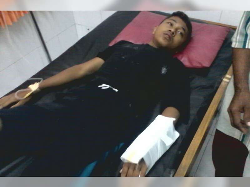 Motor Tabrak Bus Yang Berhenti Mendadak, Pengendara Motor Patah Pergelangan Tangan