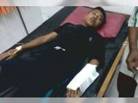 Motor Tabrak Bus Yang Berhenti Mendadak, Pengendara Motor Patah Pergelangan Tangan