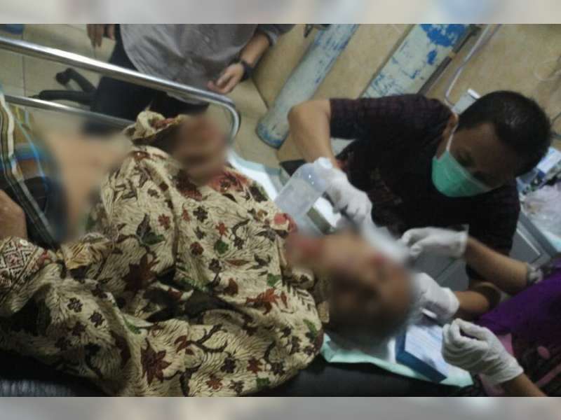 Pengendara Motor di Balen, Jadi Korban Tabrak Lari