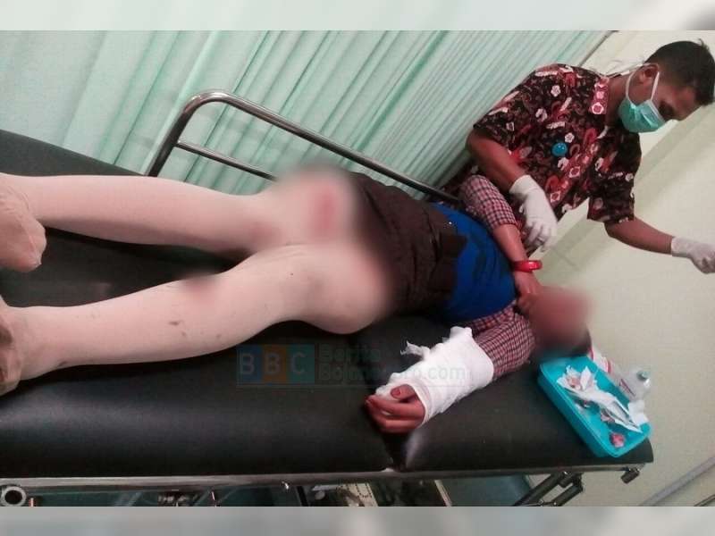 Terobos Lampu Merah, Pengendara Motor Dihantam Mobil Avanza