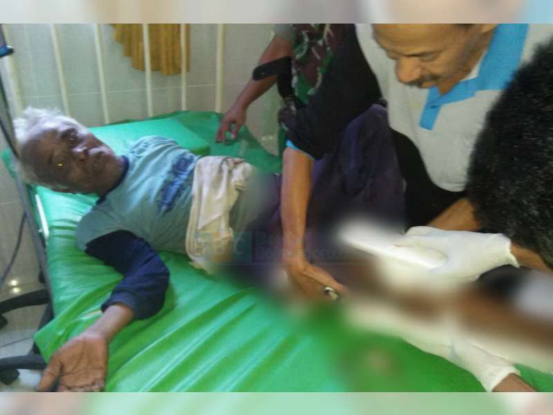 Setelah Tabrak Sopir Pikap, Pengayuh Sepeda Pancal di Balen Ditabrak Motor