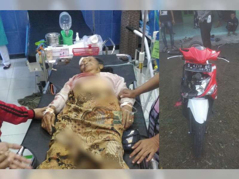 Motor Tabrak Pejalan Kaki di Baureno, Pengendara Motor dan Pejalan Kaki Sama-Sama Terluka