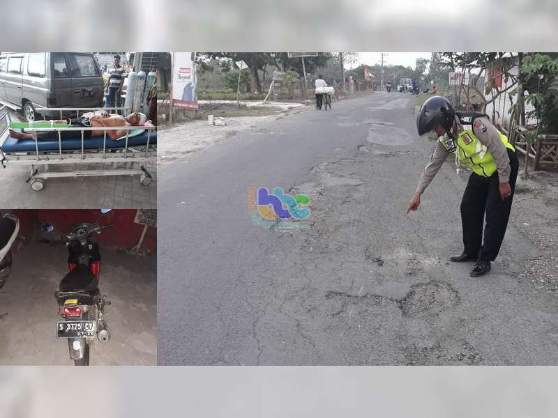 Pejalan Kaki di Ngraho Patah Kaki Akibat Dilanggar Motor