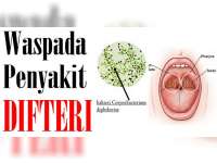 Warga Bojonegoro Perlu Waspada Penyakit Difteri