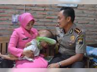 Kapolres Blora Sambangi Bocah Penderita Hidrocefalus