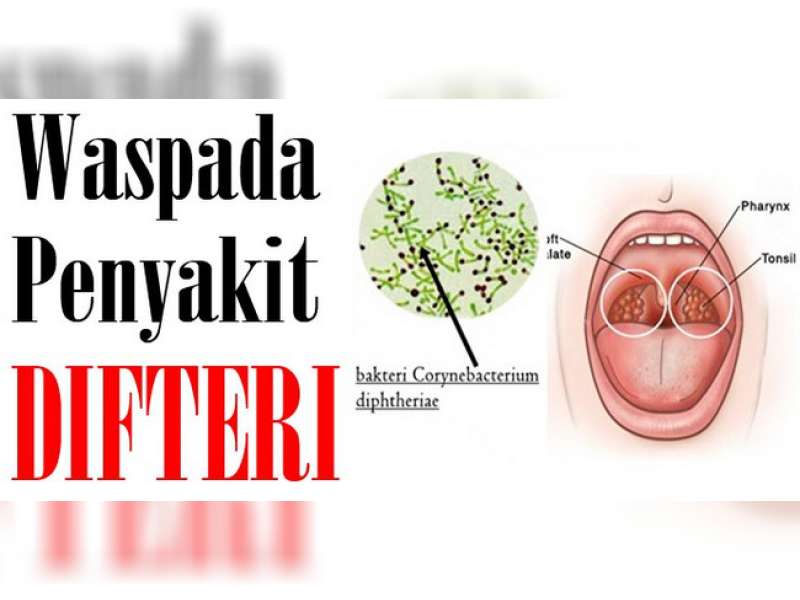 317 Ribu Anak Bojonegoro Berpotensi Terkena Difteri