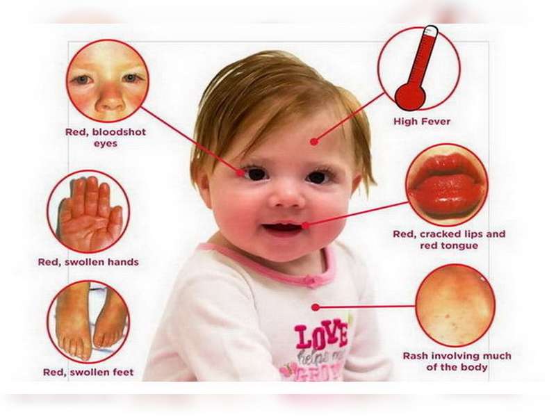 Dinkes Bojonegoro Masih Tunggu Instruksi Provinsi Terkait Kawasaki