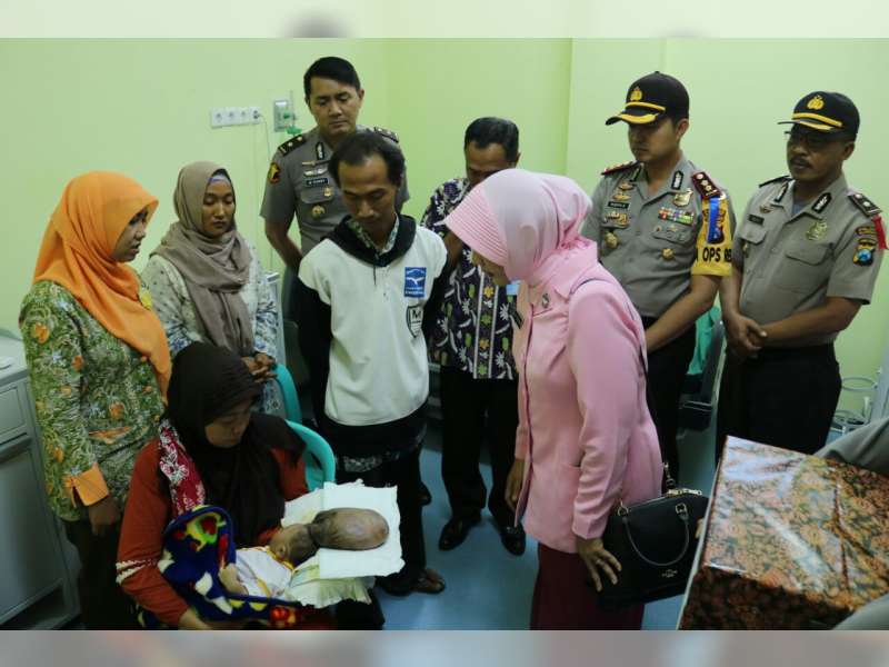 Kapolres Bojonegoro Pastikan Maulana Segera Mendapat Penanganan Medis dari Rumah Sakit