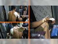 Korban Penganiayaan di Kedungadem Alami Luka Bacok di Beberapa Bagian Tubuh