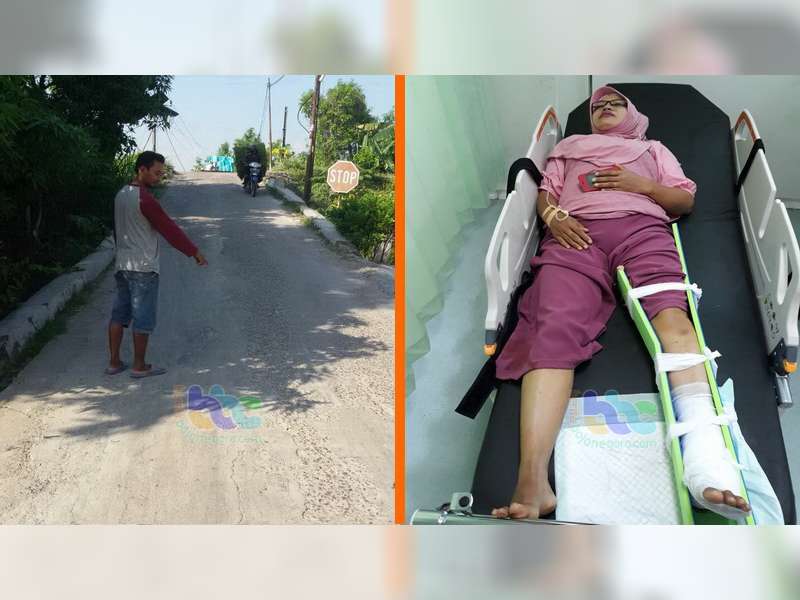 Tabrakan Motor di Padangan Bojonegoro, Seorang Pengendara Patah Kaki