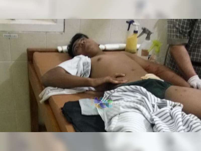 Tabrakan Motor di Dander Bojonegoro, Kedua Pengendara Dilarikan ke Rumah Sakit