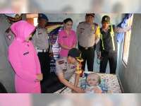 Kapolres Bojonegoro Kunjungi Anak Penderita Hidrosefalus