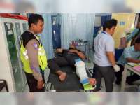 Vixion Tabrak Vario di Baureno Bojonegoro, Pengendara Vixion Patah Tulang Kaki