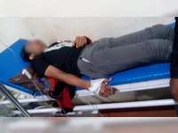 Ngebut di Tikungan, Tabrak Tembok Warga, Seorang Pemotor di Temayang Luka Berat