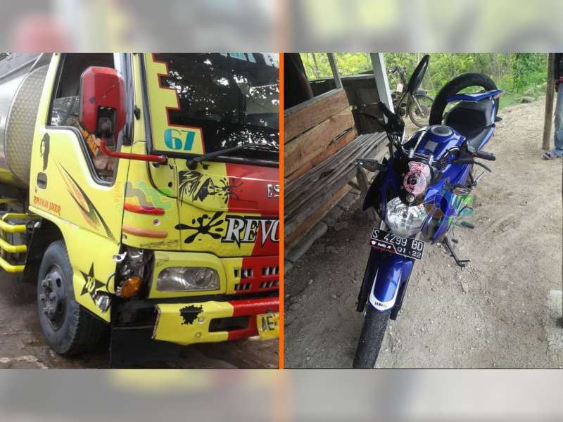 Ditabrak Truk Pemotor di Margomulyo Bojonegoro Alami Patah Kaki