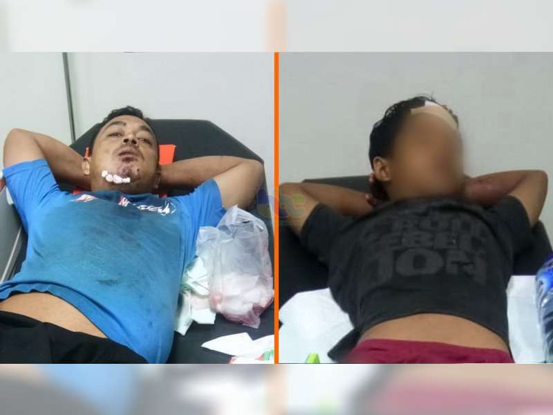 Diduga Karena Hujan, Dua Motor di Ngraho Bojonegoro Bertabrakan