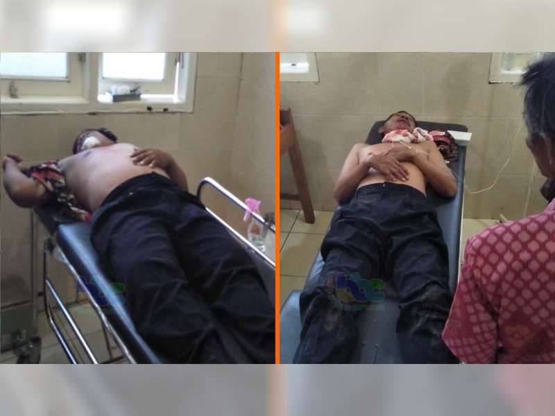 Motor Tabrak Sepeda di Dander Bojonegoro, 2 Orang Luka-Luka