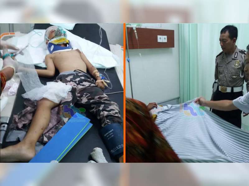 Tabrak Truk Tronton, 2 Orang Pemotor di Padangan Bojonegoro, Luka Berat