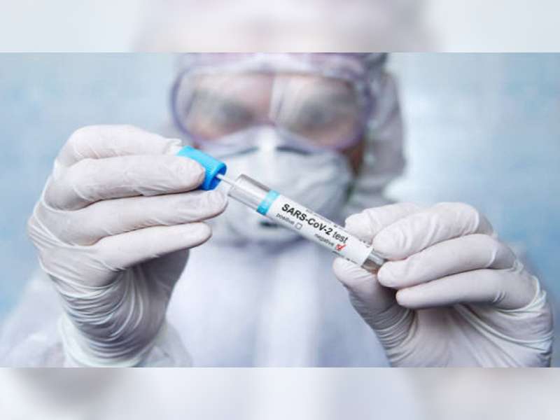 Libur Natal dan Tahun Baru, Pemudik di Blora Tidak Diwajibkan Lakukan Rapid Test Antigen