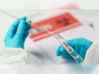 Tidak Semua Warga Bojonegoro Berhak Mendapatkan Fasilitas Rapid Antigen dan Antibodi Gratis
