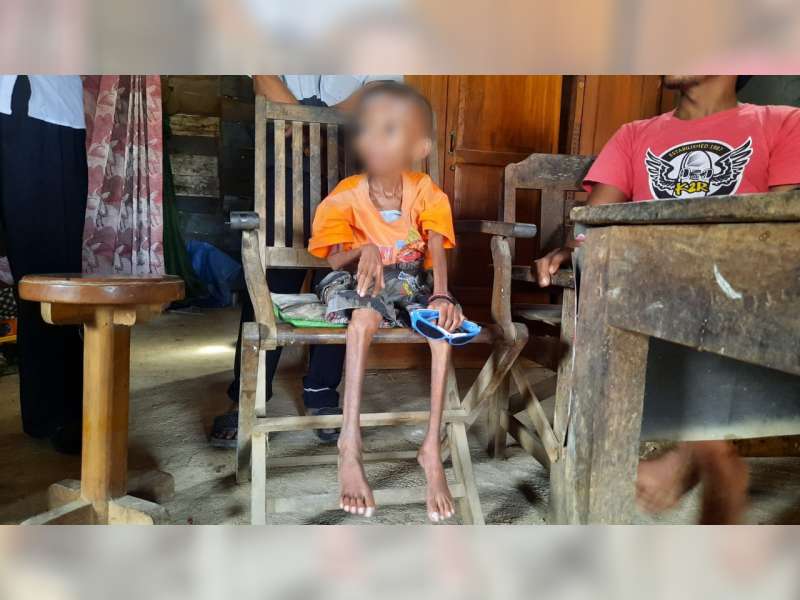 Idap Penyakit Komplikasi, Bocah 9 Tahun di Blora Ini Alami Gagal Tumbuh