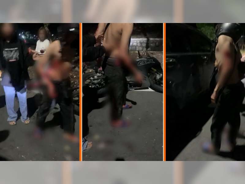 Seorang Remaja di Dander, Bojonegoro, Jadi Korban Pengeroyokan dan Pembacokan