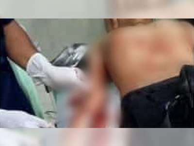 Seorang Remaja di Bojonegoro Jadi Korban Pembacokan