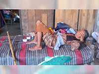 Terserang Chikungunya, Sejumlah Warga di Desa Sukosewu, Bojonegoro Lumpuh